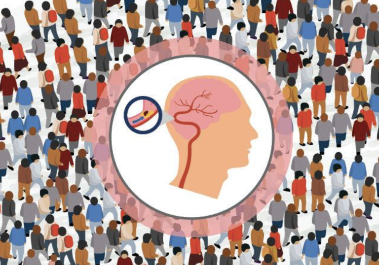 InnoStroke: AI for Stroke Risk Prediction