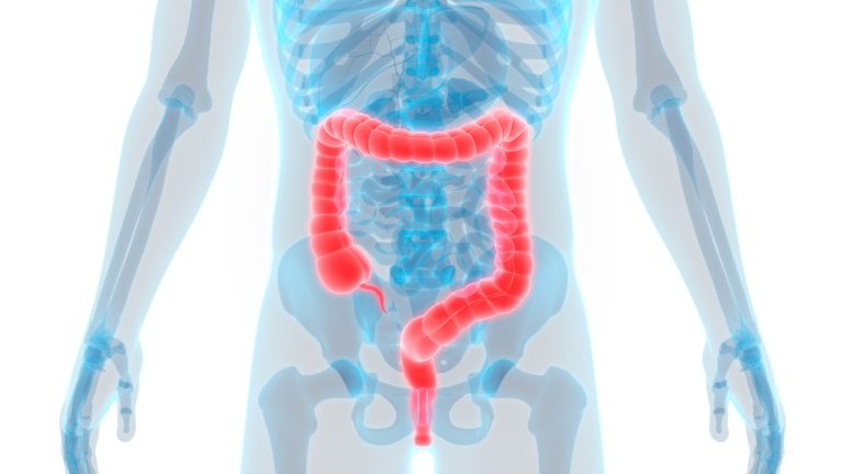 MiCRC – Early Detection of Colorectal Cancer Using Microbiome Data