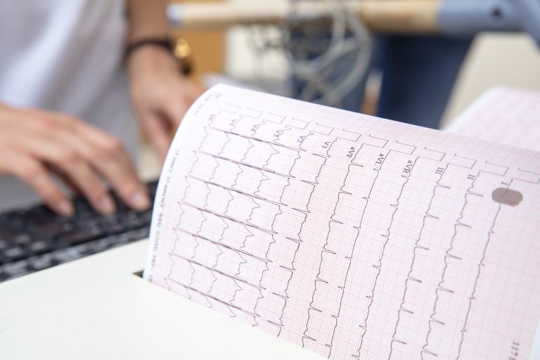 RapidAIM – Rapid Detection of Heart Attacks from ECG Images